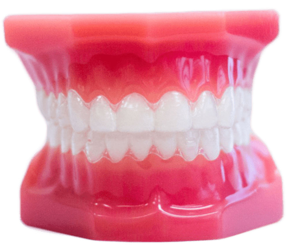 clear aligners on plastic model